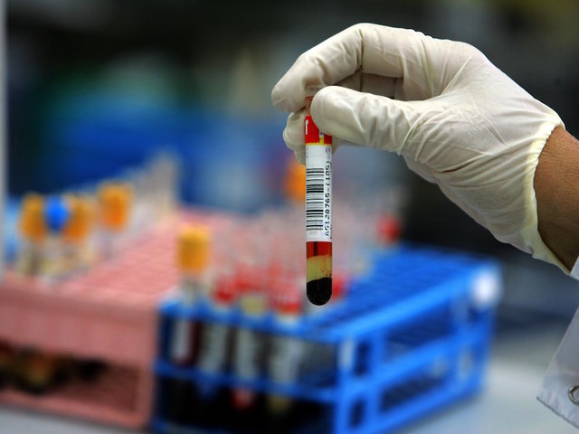 Michigan sees significant increase in number of reported gonorrhea infections